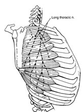long thoracic nerve palsy